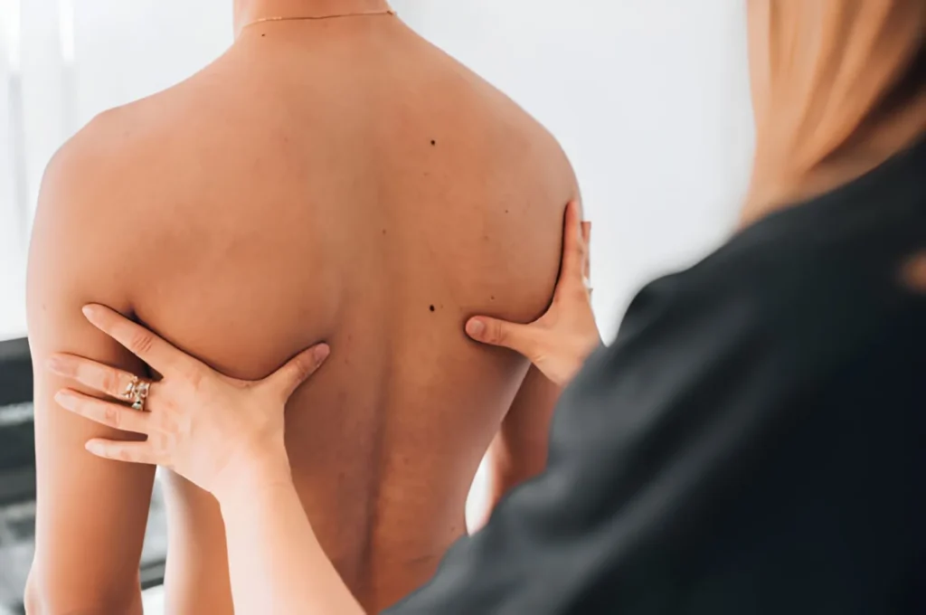 scoliosis-2